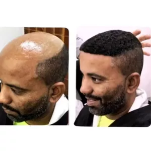 Imagem do curso Aprenda a Arte da Prótese Capilar Micropele Afro