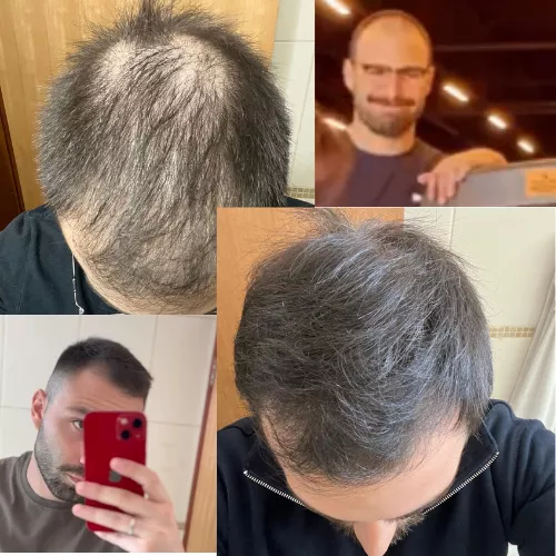 Método Cabelo Infinito - Guia Completo