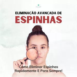 Imagem de capa para o Ebook Eliminação Avançada De Espinhas