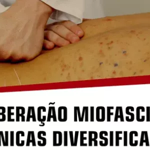 Imagem de capa para o Curso online Curso Liberação Miofascial: Técnicas Diversificadas