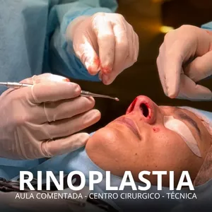 Imagem de capa para o Curso online Rinoplastia comentada