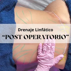 Imagen de portada para Curso online POST OPERATORIO técnicas de  "Drenaje linfático" método Brasileño