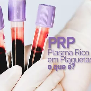 Imagem do curso Plasma Gel PRP