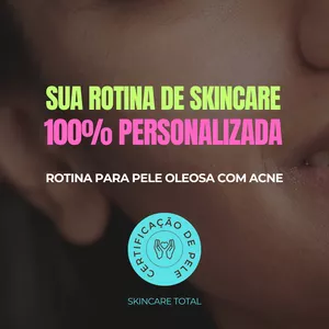 Imagem de capa para o Curso online Rotina para Pele OLEOSA com ACNE Skincare Total