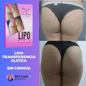 Imagen de portada para Curso online MÉTODO LIPO BUM BUM