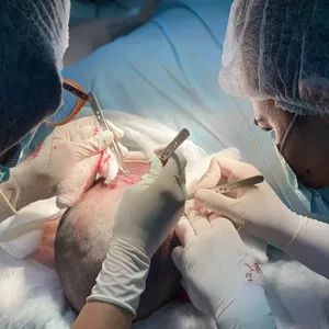 Imagen de portada para Curso online Curso de Técnico Capilar para Trasplante Capilar, Online.