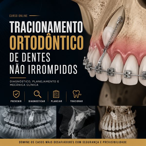Capa do curso Tracionamento Ortodôntico de Dentes Não Irrompidos