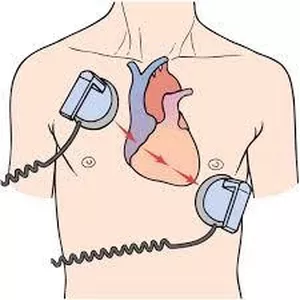 Imagem de capa para o Ebook Curso de Posicionamento e Manuseio do DEA