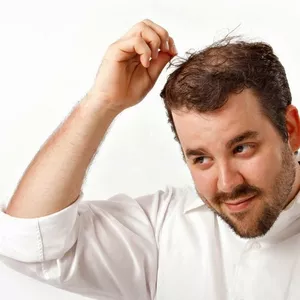 Imagem do curso Projeto Revertendo a Calvície