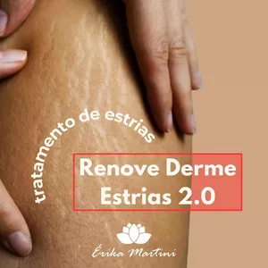 Imagem de capa para o Curso online Renove Derme Estrias 2.0