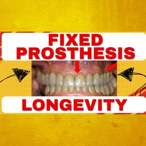 Cover image for Ebook PDF - What causes a fixed prosthesis to fail? Intraoral examination - Class 3