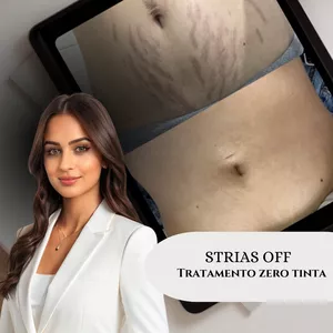 Imagem de capa para o Curso online STRIAS OFF TRATAMENTO PARA ESTRIAS ZERO TINTA