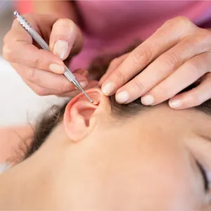 Imagem de capa para o Evento presencial Curso de Auriculoterapia: Diagnóstico e Tratamento Baseado nos Fundamentos da Medicina Tradicional Chinesa