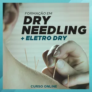 Imagem do curso Formação em Dry Needling (Agulhamento seco)