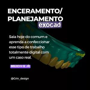 PLANEJAMENTO/ENCERAMENTO FULL NO EXOCAD por GRIN DESIGN