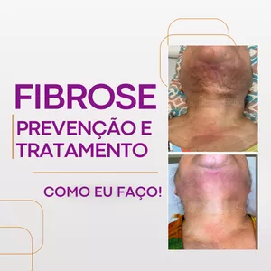 Imagem de capa para o Curso online Workshop Fibrose