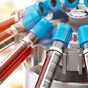 Imagem de capa para o Curso online SEGUNDO LOTE: 4 TURMA DE HEMATOLOGIA ONLINE 