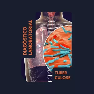 Imagem de capa para o Curso online Diagnóstico laboratorial da tuberculose
