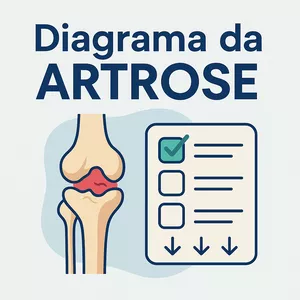 Imagem de capa para o Curso online Diagrama da Artrose