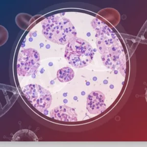 Imagem de capa para o Curso online Hematologia Laboratorial