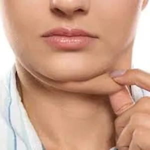 Cover image for Ebook Quick Zero Double Chin