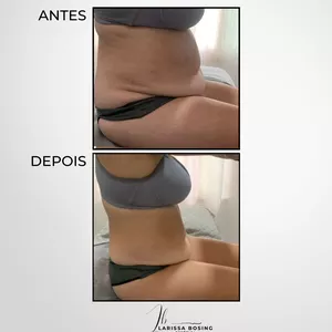 Imagem do curso DIASTASE OFF