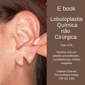 Imagem de capa para o Ebook LOBULOPLASTIA QUÍMICA NÃO CIRÚRGICA com ata 