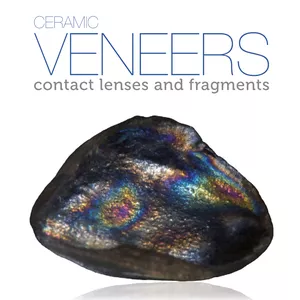 Cover image for Ebook Ceramic Veneers: Contact Lenses and Fragments