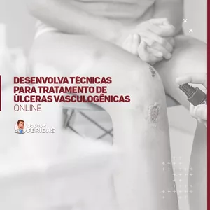 Imagem principal do produto Desenvolva técnicas para tratamento de Úlceras Vasculogênicas
