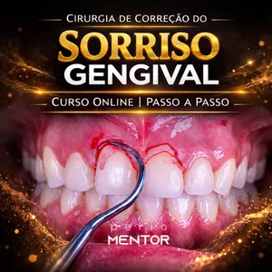 Imagem de capa para o Curso online Curso Passo a Passo Online de Sorriso Gengival