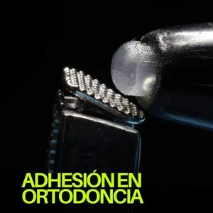 Imagen de portada para Curso online ADHESIÓN EN ORTODONCIA