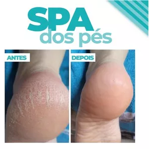 Imagem de capa para o Curso online Spa dos Pés Plástica dos Pés