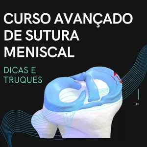 Imagem de capa para o Curso online GUIA PRÁTICO DIGITAL PARA SUTURA MENISCAL