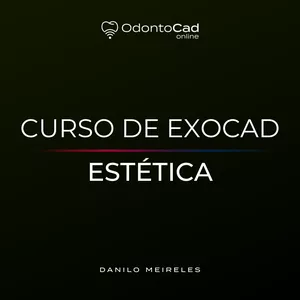 Imagem de capa para o Curso online Curso de Planejamento e Estética no Exocad