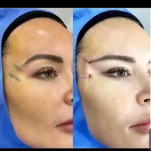 Imagem do curso Curso de Fox Eyes com Fios em PDO 