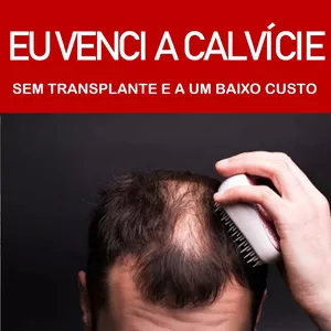 Imagem de capa para o Ebook Eu venci a calvicie