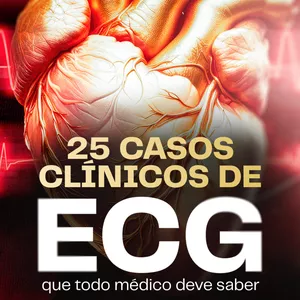 Imagem de capa para o Curso online 25 Casos Clínicos de ECG Que Todo Médico Deve Saber