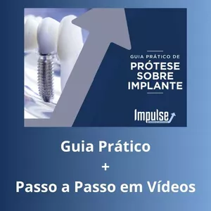 Imagem de capa para o Curso online Prótese Sobre Implante: Passo a Passo em Vídeos
