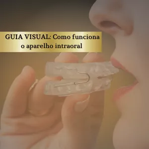 Imagem de capa para o Ebook GUIA VISUAL DO APARELHO INTRAORAL - ENTENDA NA PRÁTICA !