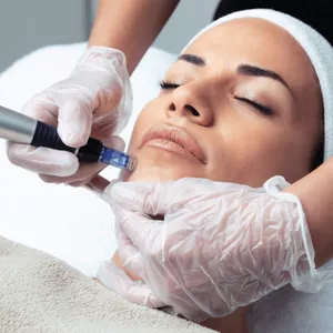 Image de couverture pour le Cours en ligne Formation Microneedling en Ligne