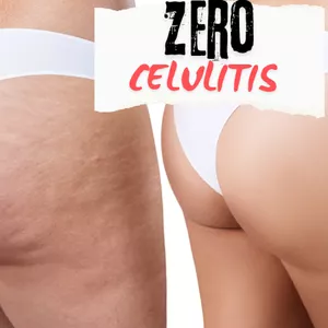 Imagen de portada para Curso online ZERO CELULITIS