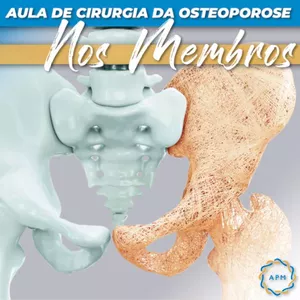 Imagem principal do produto AULA DE CIRURGIA DA OSTEOPOROSE NOS MEMBROS