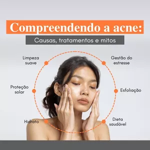 Imagem de capa para o Curso online Compreendendo a acne: causas, tratamentos e mitos