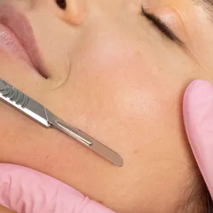 Imagem de capa para o Curso online Curso Online DERMAPLANING