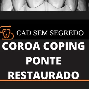 Imagem de capa para o Ebook Coroa, coping, ponte e restaurados
