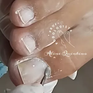 Imagem de capa para o Curso online Pedicure com excelência- Cuticulagem combinada