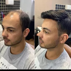 Imagem de capa para o Curso online Curso de Capacitação Profissional em Prótese Capilar