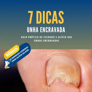 Imagem de capa para o Ebook 7 DICAS UNHA ENCRAVADA