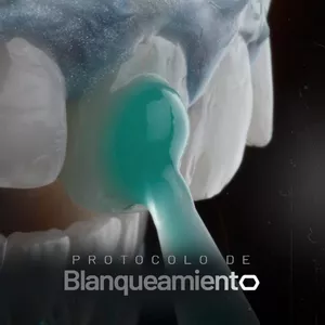 Imagen de portada para Curso online Protocolo de Blanqueamiento