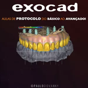 Imagem do curso EXOCAD - Aulas de PROTOCOLO do Básico ao Avançado!